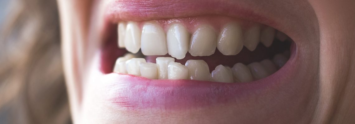 Reshaping Teeth: How to Fix Your Crooked Smile